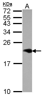 NPC2 Antibody - Sample (30 ug of whole cell lysate) A: HeLa 15% SDS PAGE NPC2 antibody diluted at 1:1000