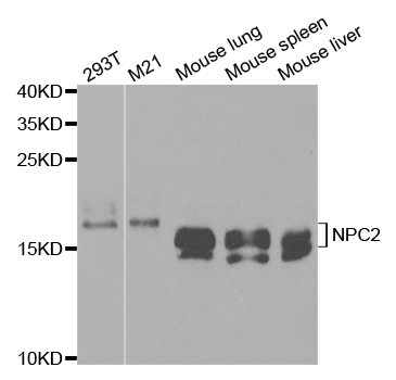 NPC2 Antibody - Western blot analysis of extracts of various cell lines.