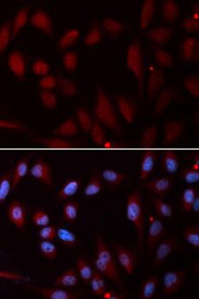 NPC2 Antibody - Immunofluorescence analysis of U20S cells.