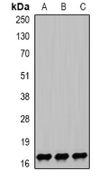 NPC2 Antibody - Western blot analysis of NPC2 expression in HEK293T (A); mouse lung (B); mouse liver (C) whole cell lysates.