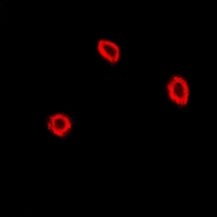 NPC2 Antibody - Immunofluorescent analysis of NPC2 staining in U2OS cells. Formalin-fixed cells were permeabilized with 0.1% Triton X-100 in TBS for 5-10 minutes and blocked with 3% BSA-PBS for 30 minutes at room temperature. Cells were probed with the primary antibody in 3% BSA-PBS and incubated overnight at 4 deg C in a humidified chamber. Cells were washed with PBST and incubated with a DyLight 594-conjugated secondary antibody (red) in PBS at room temperature in the dark.