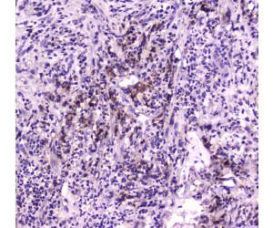 NPC2 Antibody - IHC analysis of Niemann Pick C2 using anti-Niemann Pick C2 antibody