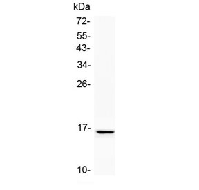 NPC2 Antibody - Western blot testing of human SK-OV-3 cell lysate with NPC2 antibody at 0.5ug/ml. Predicted molecular weight: ~17 kDa, can be observed as a ~21/23 kDa doublet in human samples. (Ref 1).