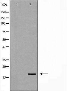 NPC2 Antibody - Western blot analysis of 293T whole cells lysates using NPC2 antibody. The lane on the left is treated with the antigen-specific peptide.