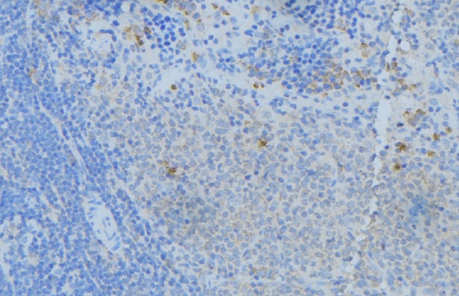 NPC2 Antibody - 1:100 staining human lymph node tissue by IHC-P. The sample was formaldehyde fixed and a heat mediated antigen retrieval step in citrate buffer was performed. The sample was then blocked and incubated with the antibody for 1.5 hours at 22°C. An HRP conjugated goat anti-rabbit antibody was used as the secondary.