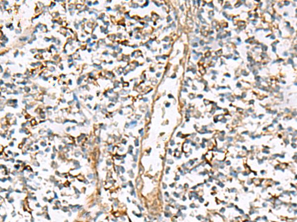 NPC2 Antibody - Immunohistochemistry of paraffin-embedded Human tonsil tissue  using NPC2 Polyclonal Antibody at dilution of 1:80(×200)