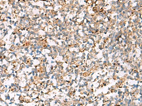 NPC2 Antibody - Immunohistochemistry of paraffin-embedded Human tonsil tissue  using NPC2 Polyclonal Antibody at dilution of 1:50(×200)