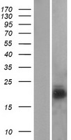 NPC2 Protein - Western validation with an anti-DDK antibody * L: Control HEK293 lysate R: Over-expression lysate
