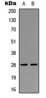 NPDC1 Antibody - Western blot analysis of NPDC1 expression in SKNSH (A); Jurkat (B) whole cell lysates.