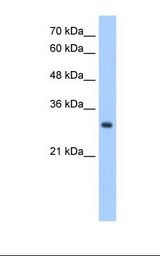 NPDC1 Antibody - Jurkat cell lysate. Antibody concentration: 2.5 ug/ml. Gel concentration: 12%.  This image was taken for the unconjugated form of this product. Other forms have not been tested.