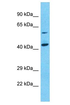 NPEPL1 Antibody - NPEPL1 antibody Western Blot of Jurkat. Antibody dilution: 1 ug/ml.  This image was taken for the unconjugated form of this product. Other forms have not been tested.