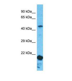 NPEPL1 Antibody - Western blot of Human ACHN. NPEPL1 antibody dilution 1.0 ug/ml.  This image was taken for the unconjugated form of this product. Other forms have not been tested.