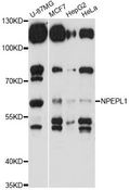 NPEPL1 Antibody - Western blot analysis of extracts of various cell lines, using NPEPL1 antibody at 1:3000 dilution. The secondary antibody used was an HRP Goat Anti-Rabbit IgG (H+L) at 1:10000 dilution. Lysates were loaded 25ug per lane and 3% nonfat dry milk in TBST was used for blocking. An ECL Kit was used for detection and the exposure time was 15s.