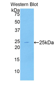 NPEPPS Antibody - Western blot of recombinant NPEPPS.  This image was taken for the unconjugated form of this product. Other forms have not been tested.