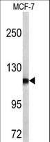 NPEPPS Antibody - Western blot of PSA antibody in MCF-7 cell line lysates (35 ug/lane). PSA (arrow) was detected using the purified antibody.