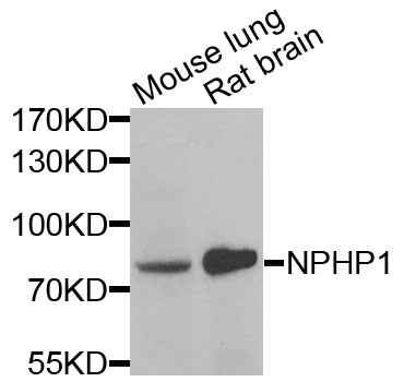 NPHP1 / Nephronophthisis Antibody - Western blot analysis of extracts of various cells.