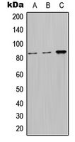 NPHP1 / Nephronophthisis Antibody - Western blot analysis of Nephrocystin 1 expression in HeLa (A); Raw264.7 (B); H9C2 (C) whole cell lysates.