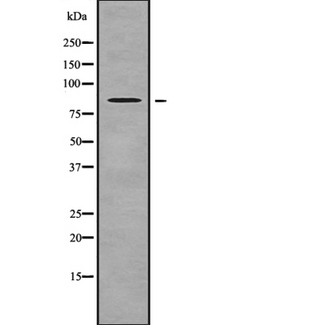 NPHP1 / Nephronophthisis Antibody - Western blot analysis NPHP1 using HepG2 whole cells lysates