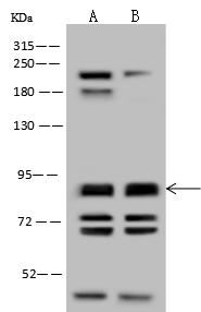 NPHP1 / Nephronophthisis Antibody - Anti-NPHP1 rabbit polyclonal antibody at 1:500 dilution. Lane A: Hela Whole Cell Lysate. Lane B: U-251 MG Whole Cell Lysate. Lysates/proteins at 30 ug per lane. Secondary: Goat Anti-Rabbit IgG (H+L)/HRP at 1/10000 dilution. Developed using the ECL technique. Performed under reducing conditions. Predicted band size: 80 kDa.