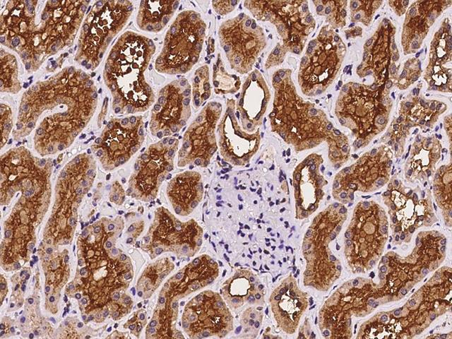 NPHP1 / Nephronophthisis Antibody - Immunochemical staining of human NPHP1 in human kidney with rabbit polyclonal antibody at 1:100 dilution, formalin-fixed paraffin embedded sections.