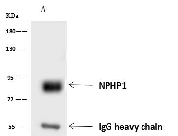 NPHP1 / Nephronophthisis Antibody - NPHP1 was immunoprecipitated using: Lane A: 0.5 mg Hela Whole Cell Lysate. 4 uL anti-NPHP1 rabbit polyclonal antibody and 60 ug of Immunomagnetic beads Protein A/G. Primary antibody: Anti-NPHP1 rabbit polyclonal antibody, at 1:100 dilution. Secondary antibody: Goat Anti-Rabbit IgG (H+L)/HRP at 1/10000 dilution. Developed using the ECL technique. Performed under reducing conditions. Predicted band size: 80 kDa. Observed band size: 80 kDa.