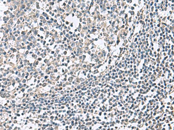 NPHP1 / Nephronophthisis Antibody - Immunohistochemistry of paraffin-embedded Human tonsil tissue  using NPHP1 Polyclonal Antibody at dilution of 1:75(×200)