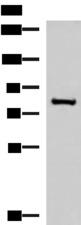 NPHP1 / Nephronophthisis Antibody - Western blot analysis of RAW264.7 cell lysate  using NPHP1 Polyclonal Antibody at dilution of 1:800