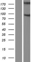NPHP1 / Nephronophthisis Protein - Western validation with an anti-DDK antibody * L: Control HEK293 lysate R: Over-expression lysate