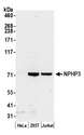 NPHP3 Antibody - Detection of human NPHP3 by western blot. Samples: Whole cell lysate (50 µg) from HeLa, HEK293T, and Jurkat cells prepared using NETN lysis buffer. Antibody: Affinity purified rabbit anti-NPHP3 antibody used for WB at 0.1 µg/ml. Detection: Chemiluminescence with an exposure time of 3 minutes.