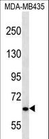 NPHP3 Antibody - NPHP3 Antibody western blot of MDA-MB435 cell line lysates (35 ug/lane). The NPHP3 antibody detected the NPHP3 protein (arrow).
