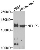 NPHP3 Antibody - Western blot analysis of extracts of various cells.