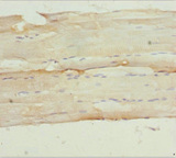 NPHP3 Antibody - Immunohistochemistry of paraffin-embedded human skeletal muscle tissue at dilution 1:100