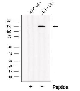 NPHP3 Antibody - Western blot analysis of extracts of HEK293 cells using NPHP3 antibody. The lane on the left was treated with blocking peptide.