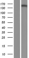 NPHP4 Protein - Western validation with an anti-DDK antibody * L: Control HEK293 lysate R: Over-expression lysate