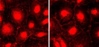 NPHS1 / Nephrin Antibody - Immunofluorescence of cultured mouse podocyte cells for nephrin