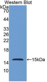 NPHS1 / Nephrin Antibody - Western Blot; Sample: Recombinant protein.