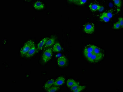 NPHS1 / Nephrin Antibody - Immunofluorescence staining of HepG2 cells with NPHS1 Antibody at 1:125, counter-stained with DAPI. The cells were fixed in 4% formaldehyde, permeabilized using 0.2% Triton X-100 and blocked in 10% normal Goat Serum. The cells were then incubated with the antibody overnight at 4°C. The secondary antibody was Alexa Fluor 488-congugated AffiniPure Goat Anti-Rabbit IgG(H+L).