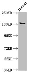 NPHS1 / Nephrin Antibody - Western Blot Positive WB detected in: Jurkat whole cell lysate All lanes: NPHS1 antibody at 5.6µg/ml Secondary Goat polyclonal to rabbit IgG at 1/50000 dilution Predicted band size: 135, 131 kDa Observed band size: 135 kDa