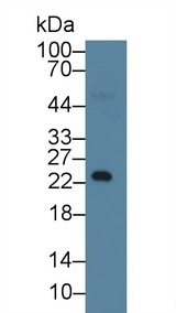 NPHS1 / Nephrin Antibody - Western Blot; Sample: Human Serum; Primary Ab: 1µg/ml Mouse Anti-Human RBP4 Antibody Second Ab: 0.2µg/mL HRP-Linked Caprine Anti-Mouse IgG Polyclonal Antibody