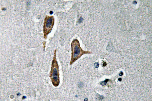 NPHS1 / Nephrin Antibody - IHC of Nephrin (H892) pAb in paraffin-embedded human brain tissue.