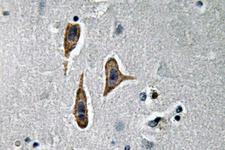 NPHS1 / Nephrin Antibody - IHC of Nephrin (H892) pAb in paraffin-embedded human brain tissue.