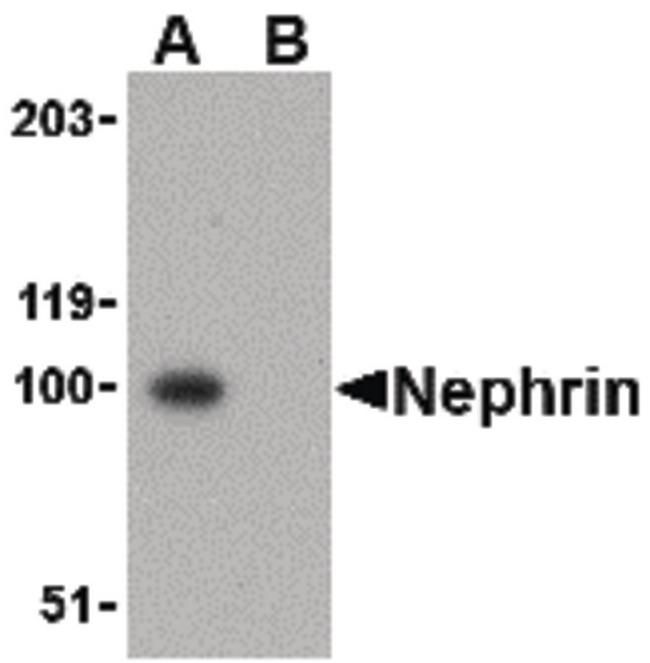 NPHS1 / Nephrin Antibody - Western blot of Nephrin in mouse kidney tissue lysate with Nephrin antibody at 1 ug/ml in the (A) absence and (B) presence of blocking peptide.