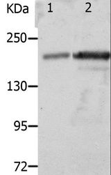 NPHS1 / Nephrin Antibody - Western blot analysis of Mouse spleen and kidney tissue, using NPHS1 Polyclonal Antibody at dilution of 1:800.