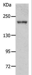 NPHS1 / Nephrin Antibody - Western blot analysis of Mouse kidney tissue, using NPHS1 Polyclonal Antibody at dilution of 1:700.