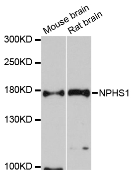 NPHS1 / Nephrin Antibody - Western blot analysis of extracts of various cell lines, using NPHS1 antibody at 1:1000 dilution. The secondary antibody used was an HRP Goat Anti-Rabbit IgG (H+L) at 1:10000 dilution. Lysates were loaded 25ug per lane and 3% nonfat dry milk in TBST was used for blocking. An ECL Kit was used for detection and the exposure time was 90s.