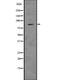 NPHS1 / Nephrin Antibody - Western blot analysis Nephrin using mouse kidney tissue lysates