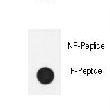 NPHS1 / Nephrin Antibody - Dot blot of anti-Phospho-Nephrin (Y1210) antibody Phospho-specific antibody on nitrocellulose membrane. 50ng of Phospho-peptide or Non Phospho-peptide per dot were adsorbed. Antibody working concentrations are 0.6ug per ml.