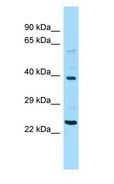 NPIPA1 / NPIP Antibody - NPIPA1 / NPIP antibody Western Blot of HeLa.  This image was taken for the unconjugated form of this product. Other forms have not been tested.