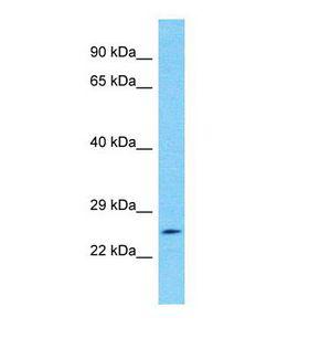 NPIPA5 Antibody - Western blot of Human Jurkat. LOC339047 antibody dilution 1.0 ug/ml.  This image was taken for the unconjugated form of this product. Other forms have not been tested.