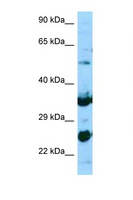 NPL / C112 Antibody - NPL antibody Western blot of Jurkat Cell lysate. Antibody concentration 1 ug/ml.  This image was taken for the unconjugated form of this product. Other forms have not been tested.